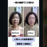 画像255