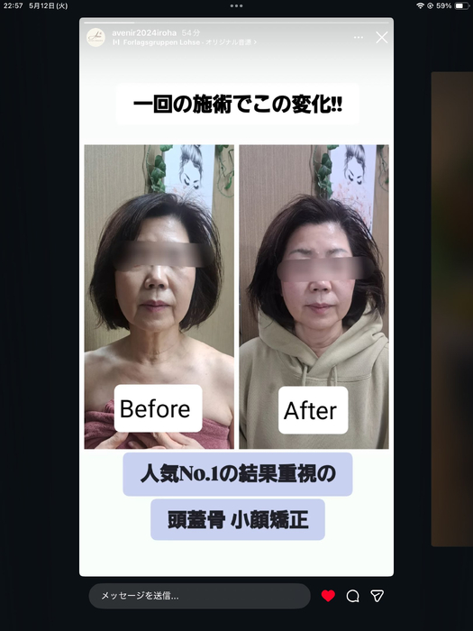 画像255